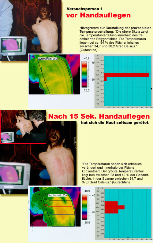 Thermografie einer Geistheilung - beim Handauflegen Thermografie einer Geistheilung - beim Handauflegen